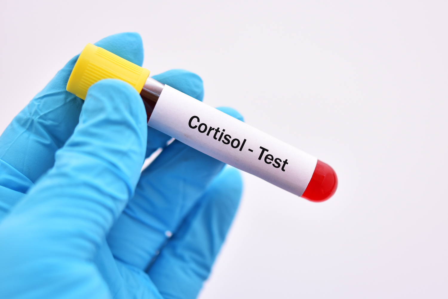 Cortisol blood test.